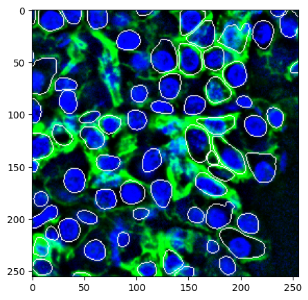 ../_images/notebooks_cell_segmentation_10_1.png
