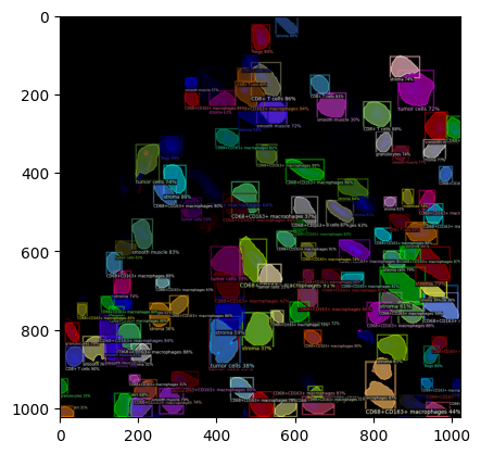 ../_images/notebooks_tissue_annotation_14_1.png